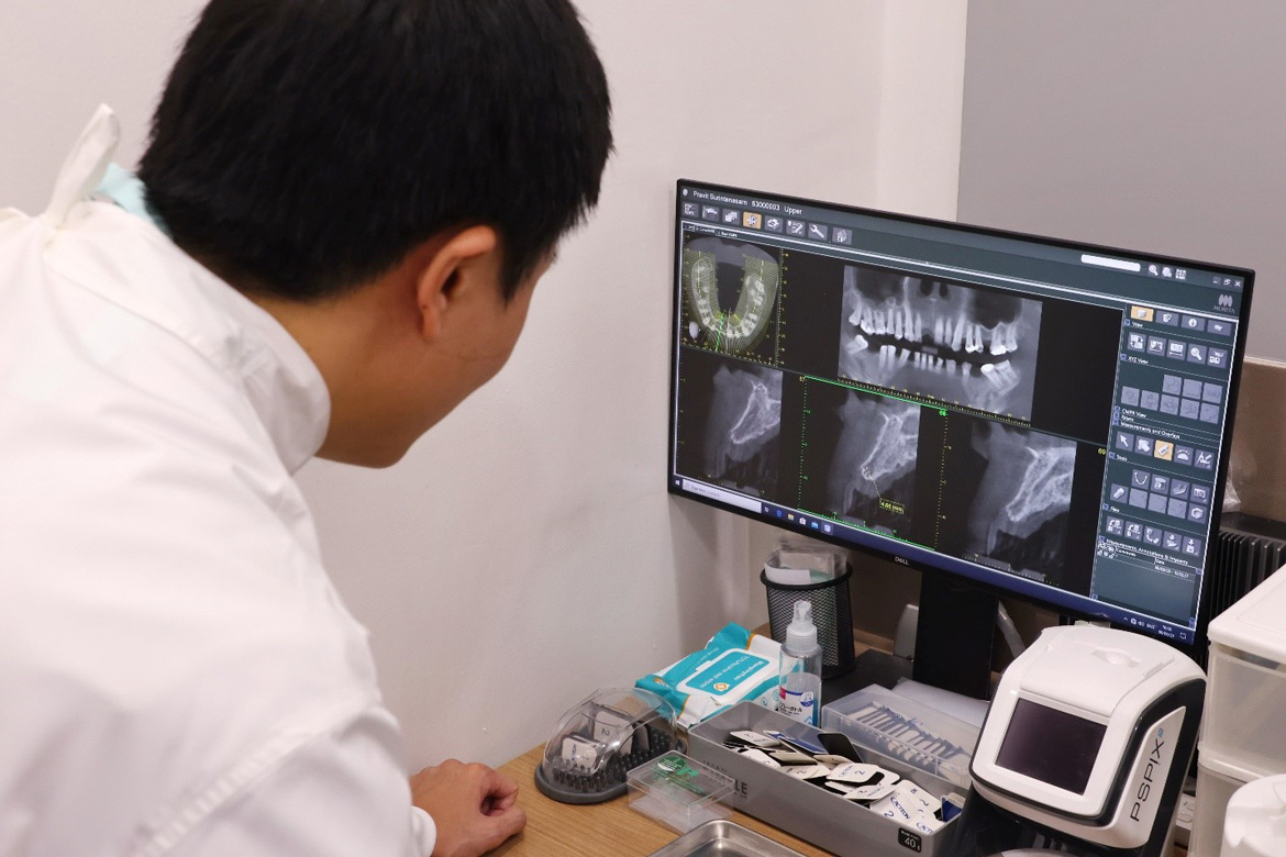 Dental Implants for International Patients