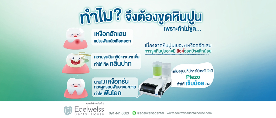 หินปูนมาจากไหน? แล้วทำไมจึงต้องขูดหินปูน?