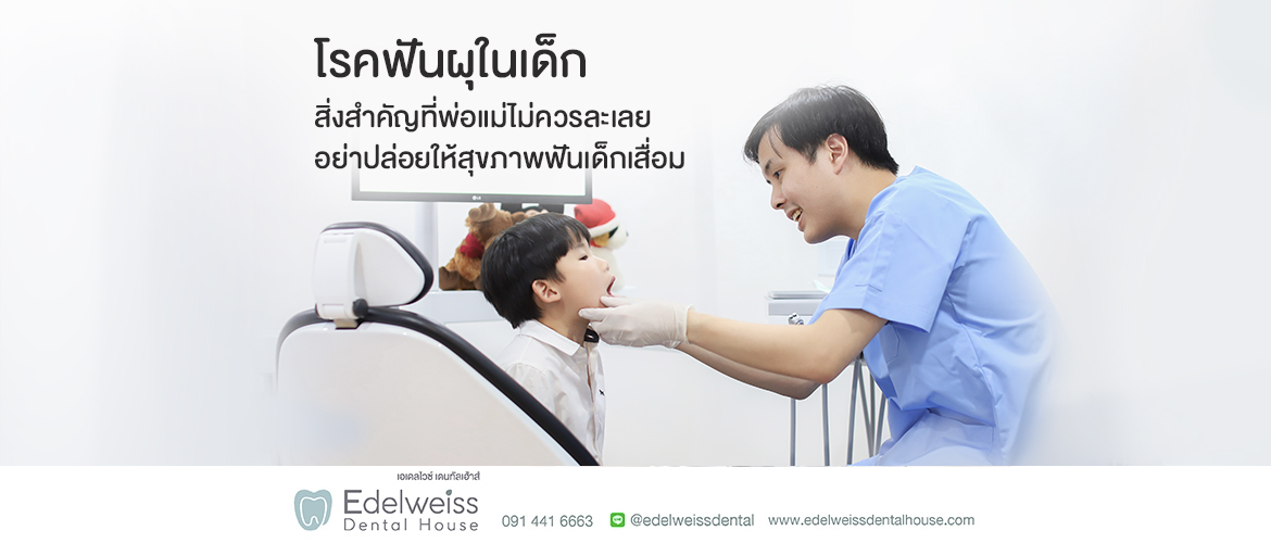 โรคฟันผุในเด็ก สิ่งสำคัญที่พ่อแม่ไม่ควรละเลย อย่าปล่อยให้สุขภาพฟันเด็กเสื่อม